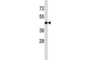 Image no. 2 for anti-Bone Morphogenetic Protein 7 (BMP7) (AA 280-309) antibody (ABIN3030180)