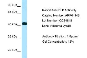 Image no. 1 for anti-Rab Interacting Lysosomal Protein (RILP) (C-Term) antibody (ABIN2789747)