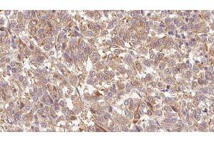 Image no. 2 for anti-S100 Calcium Binding Protein A7 (S100A7) (C-Term) antibody (ABIN6264905)