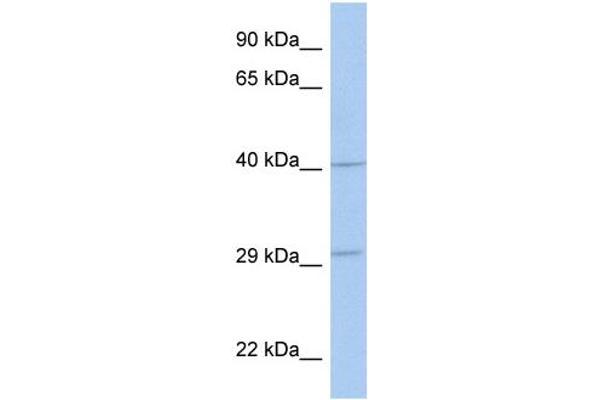 anti-ADP-Ribosyltransferase 5 (ART5) (Middle Region) antibody