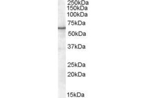 Image no. 2 for anti-Retinoid X Receptor, alpha (RXRA) (Internal Region) antibody (ABIN185295)