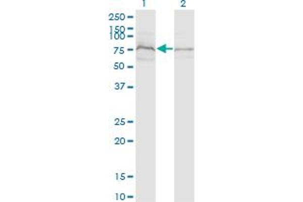 anti-Zinc Finger, DHHC-Type Containing 8 (ZDHHC8) (AA 1-42) antibody