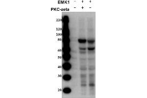 Image no. 2 for anti-MAP/microtubule Affinity-Regulating Kinase 2 (MARK2) (Isoform A), (pThr595) antibody (ABIN129661)