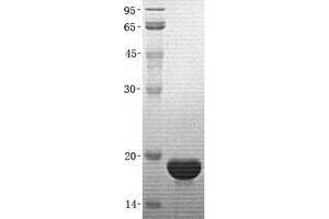 Image no. 1 for Stathmin 1 (STMN1) (Transcript Variant 4) protein (His tag) (ABIN2732834)