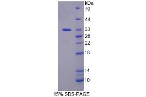 Image no. 1 for Replication Factor C (Activator 1) 2, 40kDa (RFC2) protein (ABIN6119539)