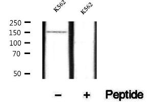 Image no. 2 for anti-Inositol Polyphosphate Phosphatase-Like 1 (INPPL1) (pTyr986), (pTyr987) antibody (ABIN6256081)