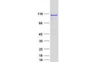 Image no. 1 for TBC1 Domain Family, Member 2 (TBC1D2) protein (Myc-DYKDDDDK Tag) (ABIN2733260)