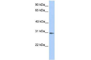 Image no. 1 for anti-Abhydrolase Domain Containing 13 (ABHD13) (N-Term) antibody (ABIN2784067)