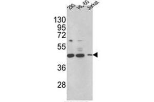 Image no. 1 for anti-Hydroxysteroid (17-Beta) Dehydrogenase 7 (HSD17B7) (N-Term) antibody (ABIN453116)