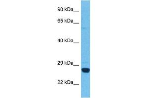 Image no. 3 for anti-Prostaglandin D2 Synthase (PTGDS) (N-Term) antibody (ABIN2783496)