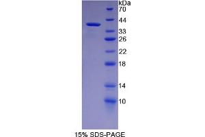 Image no. 1 for phospholipid Scramblase 1 (PLSCR1) (AA 1-318) protein (His tag) (ABIN6236786)