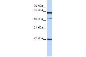 anti-Chromosome 6 Open Reading Frame 25 (C6orf25) (N-Term) antibody