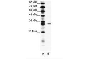 Image no. 1 for anti-Kv Channel Interacting Protein 4 (KCNIP4) (AA 27-76) antibody (ABIN202125)