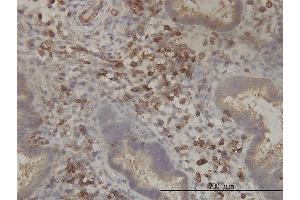 Image no. 1 for anti-Pantothenate Kinase 2 (PANK2) (AA 205-260) antibody (ABIN566414)