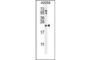 Image no. 2 for anti-RAB10, Member RAS Oncogene Family (RAB10) (AA 96-125), (Middle Region) antibody (ABIN954403)