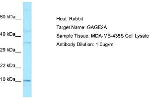 Image no. 1 for anti-G Antigen 2A (GAGE2A) (C-Term) antibody (ABIN2790004)
