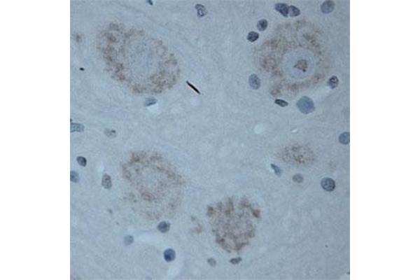 CNTNAP2 antibody  (Extracellular Domain)