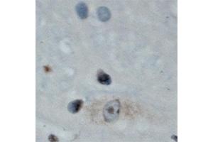 Image no. 2 for anti-SH3 and Multiple Ankyrin Repeat Domains 3 (SHANK3) (Internal Region) antibody (ABIN350831)