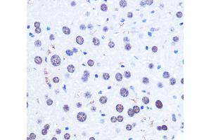 Immunohistochemistry of paraffin-embedded Mouse liver using CHD4 Polyclonal Antibody at dilution of 1:100 (40x lens).