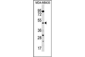 Image no. 2 for anti-Sorting Nexin 4 (SNX4) (AA 398-428), (C-Term) antibody (ABIN954892)