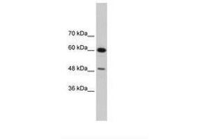 Image no. 3 for anti-DAZ Associated Protein 1 (DAZAP1) (AA 321-370) antibody (ABIN202449)