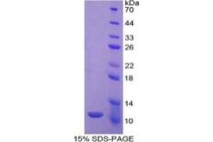 Image no. 6 for Indoleamine 2,3-Dioxygenase (IDO) ELISA Kit (ABIN6730945)