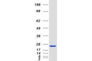 Image no. 1 for DCTP Pyrophosphatase 1 (DCTPP1) protein (Myc-DYKDDDDK Tag) (ABIN2735706)