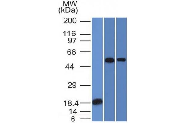 anti-TOX High Mobility Group Box Family Member 3 (TOX3) (AA 251-389) antibody