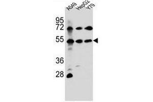 Image no. 2 for anti-Fibroblast Growth Factor Receptor-Like 1 (FGFRL1) (N-Term) antibody (ABIN952316)
