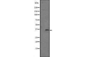 Image no. 2 for anti-Fructosamine 3 Kinase (FN3K) (Internal Region) antibody (ABIN6257182)