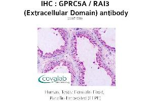 Image no. 2 for anti-G Protein-Coupled Receptor, Family C, Group 5, Member A (GPRC5A) (2nd Extracellular Domain) antibody (ABIN1735207)