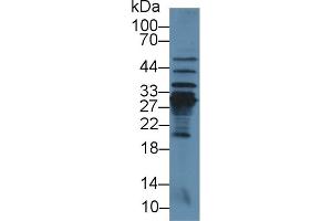 Image no. 3 for anti-C-Reactive Protein (CRP) (AA 20-230) antibody (ABIN1077879)