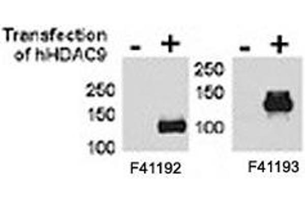 HDAC9 Antikörper  (AA 2-32)