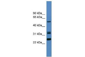 Image no. 1 for anti-Leucine Rich Repeat (In FLII) Interacting Protein 2 (LRRFIP2) (N-Term) antibody (ABIN2787914)