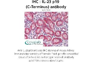 Image no. 3 for anti-Interleukin 23, alpha subunit p19 (IL23A) antibody (ABIN1735878)
