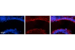 Image no. 4 for anti-MICAL-Like 1 (MICALL1) (N-Term) antibody (ABIN2784573)