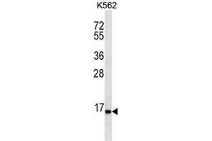 Image no. 1 for anti-Serine Peptidase Inhibitor, Kazal Type 8 (SPINK8) (AA 62-91), (C-Term) antibody (ABIN954930)