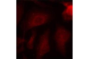 Image no. 1 for anti-Microtubule-Associated Protein tau (MAPT) (pSer404) antibody (ABIN3019704)