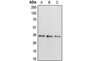 anti-Apolipoprotein L, 2 (APOL2) (Center) antibody