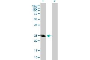 Image no. 2 for anti-Alcohol Dehydrogenase 6 (Class V) (ADH6) (AA 1-295) antibody (ABIN513139)
