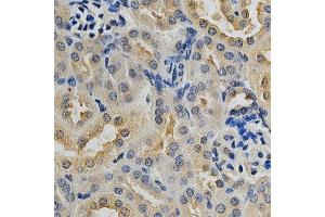 Image no. 4 for anti-Mitogen-Activated Protein Kinase 10 (MAPK10) antibody (ABIN3022948)