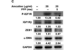 Image no. 37 for anti-Glyceraldehyde-3-Phosphate Dehydrogenase (GAPDH) (Center) antibody (ABIN2857072)