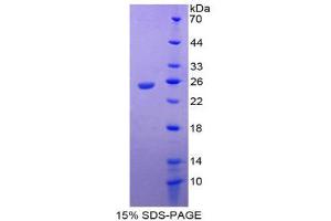Image no. 1 for Interleukin 17 Receptor E (IL17RE) (AA 457-630) protein (His tag) (ABIN1877510)