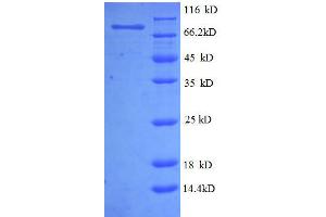 Image no. 1 for 5'-Nucleotidase, Ecto (CD73) (NT5E) (AA 28-547), (partial) protein (GST tag) (ABIN1046372)