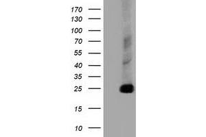 Image no. 1 for anti-ClpP Caseinolytic Peptidase, ATP-Dependent, Proteolytic Subunit Homolog (E. Coli) (CLPP) antibody (ABIN1497536)