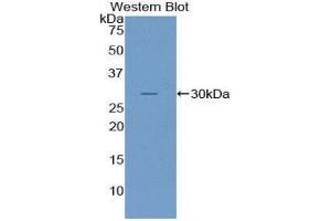 Image no. 1 for anti-Nucleoporin 107kDa (NUP107) (AA 554-784) antibody (ABIN1860076)