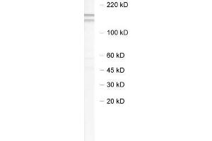 Image no. 1 for anti-E3 ubiquitin-protein ligase NEDD4-like (NEDD4L) antibody (ABIN2690521)
