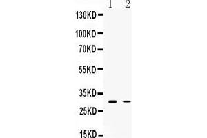Image no. 1 for anti-Tumor Necrosis Factor-Inducible Protein 6 (TNFAIP6) (AA 46-91), (N-Term) antibody (ABIN5518793)