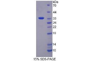 Image no. 1 for Single-Strand-Selective Monofunctional Uracil-DNA Glycosylase 1 (SMUG1) (AA 1-270) protein (His tag) (ABIN6237202)