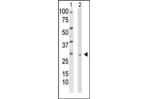 TK2 anticorps  (N-Term)